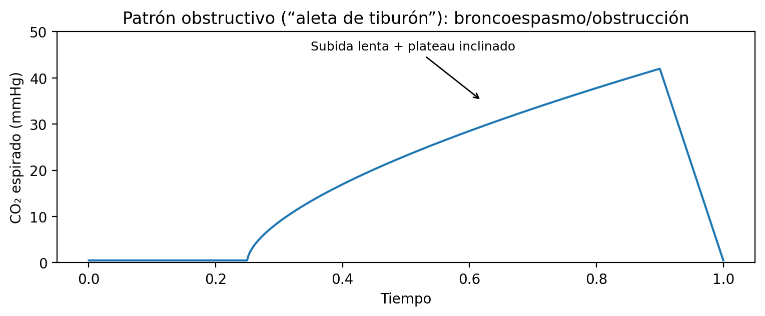 Capnograma obstructivo tipo aleta de tiburón